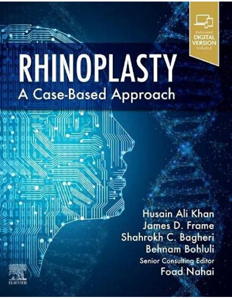RHINOPLASTY
