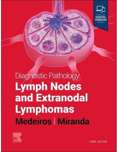 Diagnostic pathology lymph nodes and extranodal lymphomas