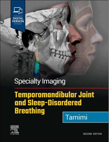 SPECIALTY IMAGING TEMPOROMANDIBULAR JOINT AND SLEEP DISORD