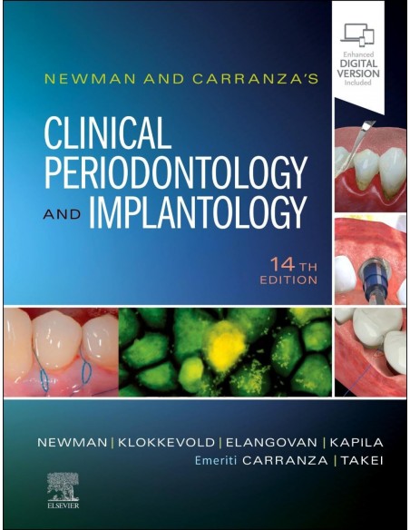 Newman and carranza s clinical periodontology implantology