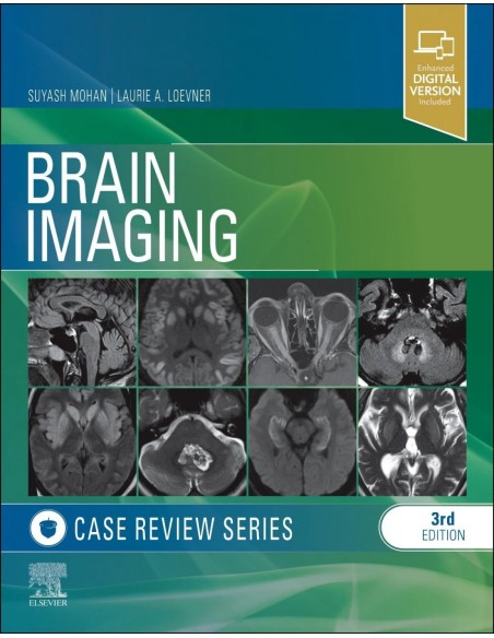 Brain imaging case review series