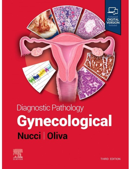 Diagnostic pathology gynecological