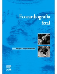 ECOCARDIOGRAFIA FETAL