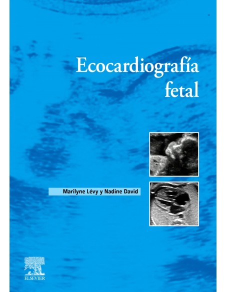 ECOCARDIOGRAFIA FETAL