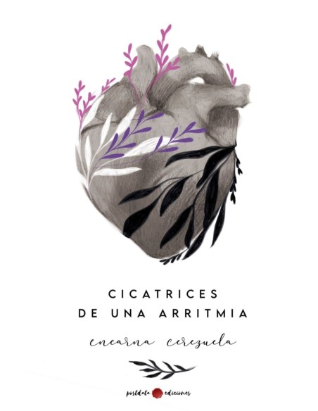 Cicatrices de una arritmia