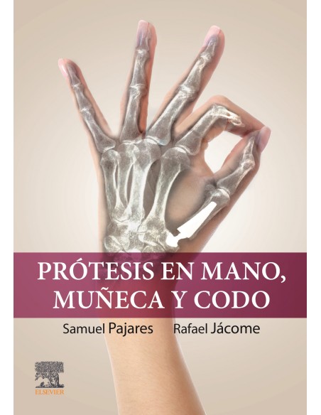 Protesis en mano muneca y codo