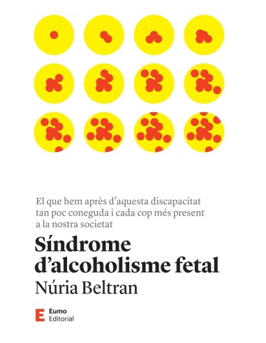 Sindrome d alcoholisme fetal