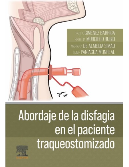 ABORDAJE DE LA DISFAGIA EN EL PACIENTE TRAQUEOSTOMIZADO