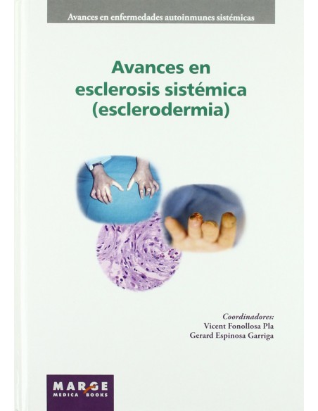 Avances en esclerosis sistemica esclerodermia