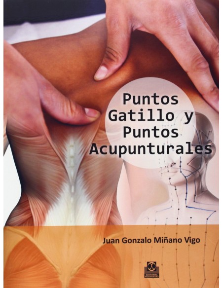 Puntos gatillo y puntos acupunturales