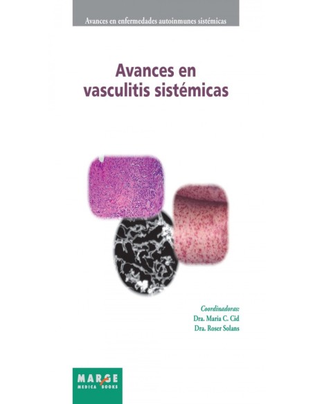 AVANCES EN VASCULITIS SISTEMICAS