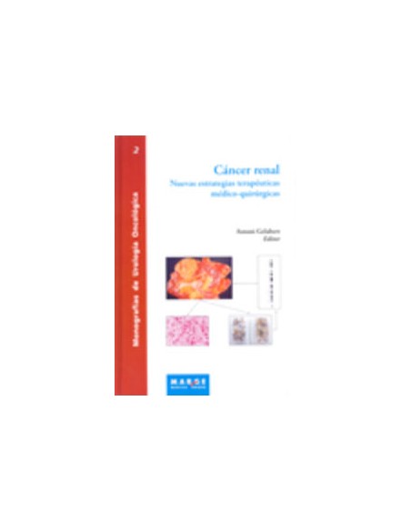 Cancer renal