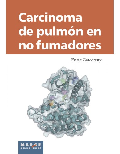 Carcinoma de pulmon en no fumadores