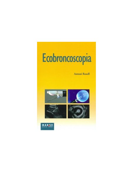 ECOBRONCOSCOPIA