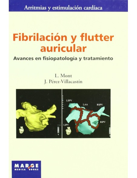 Fibrilacion y flutter auricular