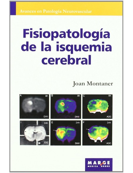 Fisiopatologia de la isquemia cerebral