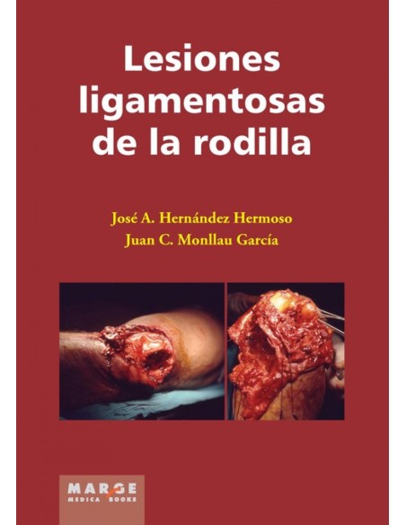 LESIONES LIGAMENTOSAS DE LA RODILLA