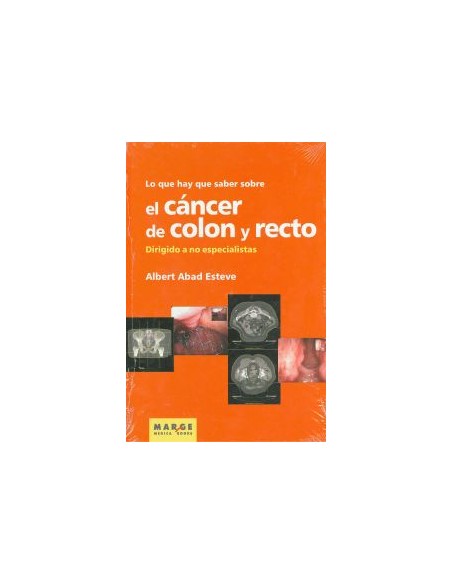 Lo que hay que saber sobre el cancer de colon y recto