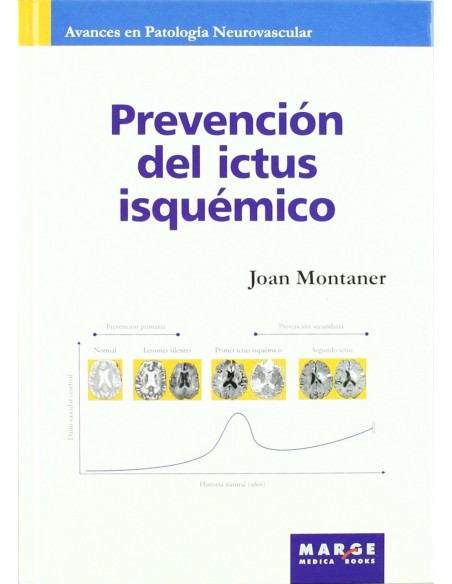Prevencion del ictus isquemico