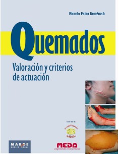 QUEMADOS VALORACION Y CRITERIO