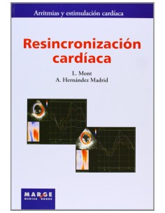 Resincronizacion cardiaca