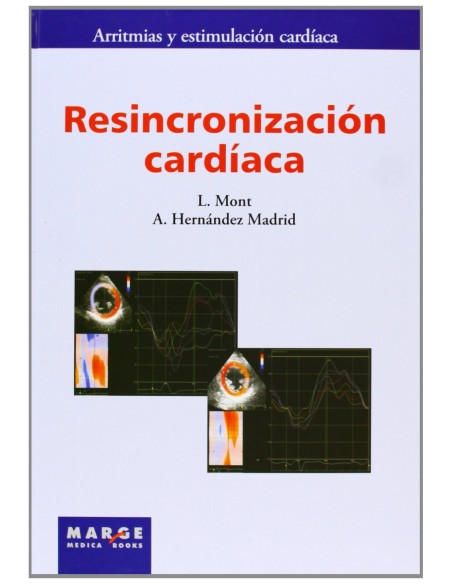 Resincronizacion cardiaca