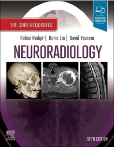 Neuroradiology the core requisites