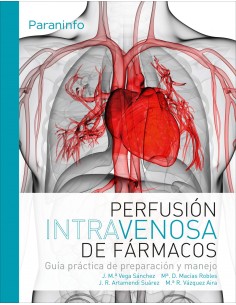 Perfusion intravenosa de farmacos