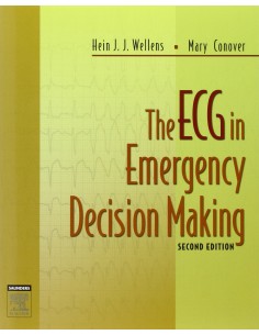 The ECG in Emergency Decision Making