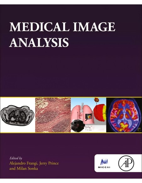 Medical image analysis