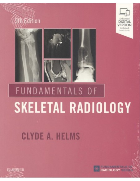 FUNDAMENTALS OF SKELETAL RADIOLOGY