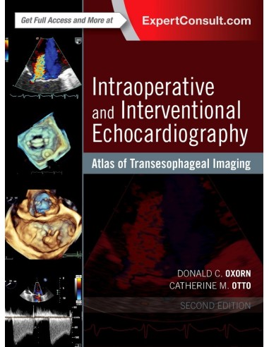 Intraoperative and Interventional Echocardiography
