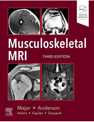 Musculoeskeletal mri