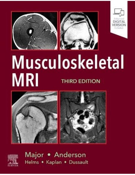 Musculoeskeletal mri