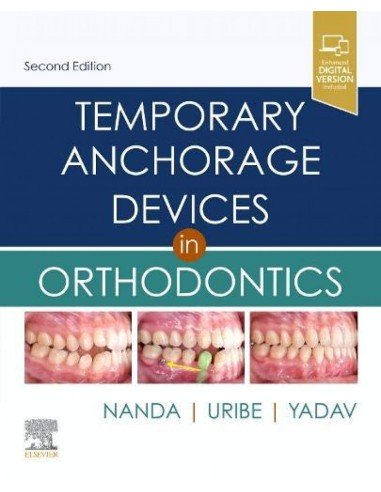 Temporary anchorage devices in orthodonitcs