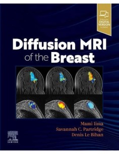 DIFFUSION MRI OF THE BREAST