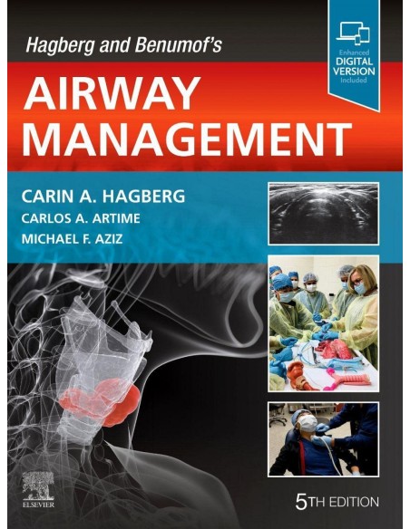 Hagberg and benumofs airway management