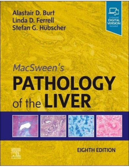 Macsweens pathology of liver