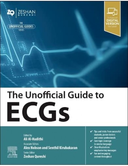 The unofficial guide to ecgs