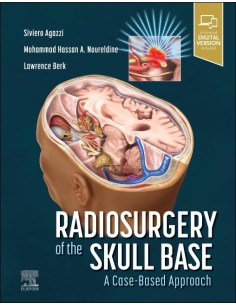RADIOSURGERY OF THE SKULL BASE A CASE BASED APPROACH