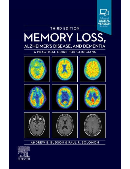MEMORY LOSSALZHEIMER S DISEASE AND DEMENTIA 3RDEDITION