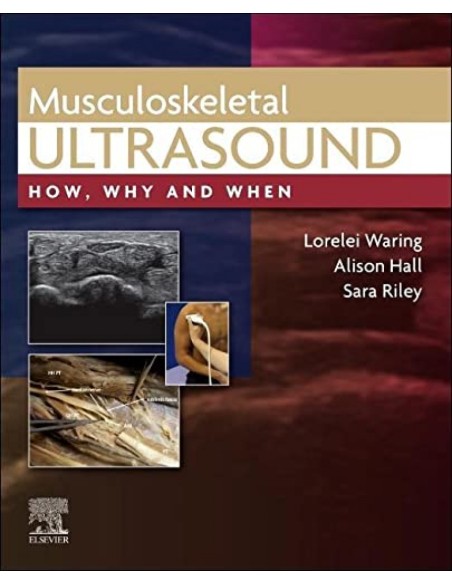 Musculoskeletal ultrasound