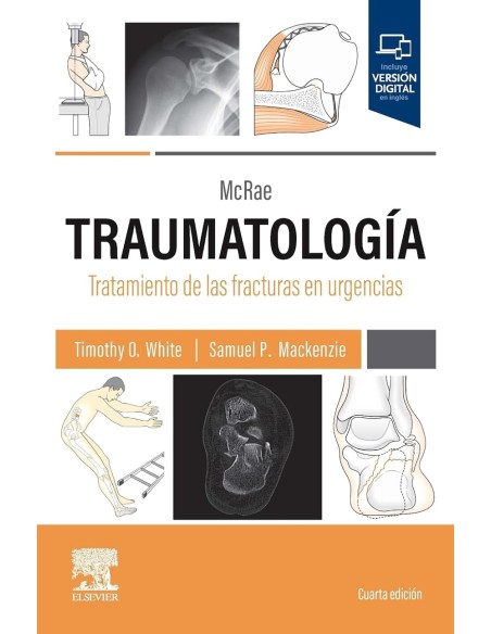 MCRAETRAUMATOLOGIATRATAMIENTO FRACTURAS EN URGENCIAS