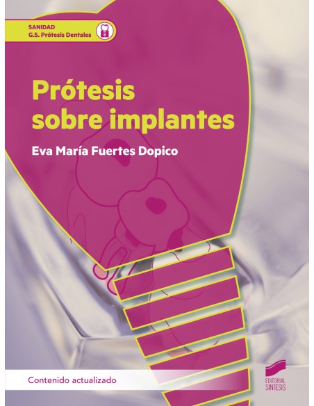Protesis sobre implantes