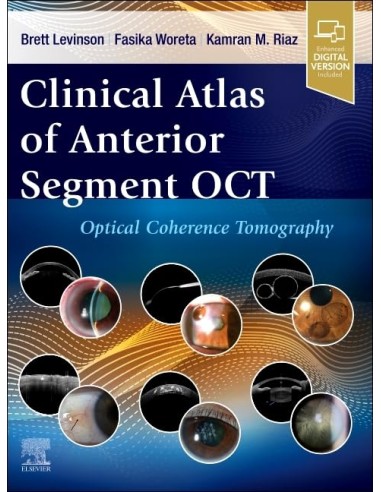 Clinical atlas of anterior segment oct optical coherence