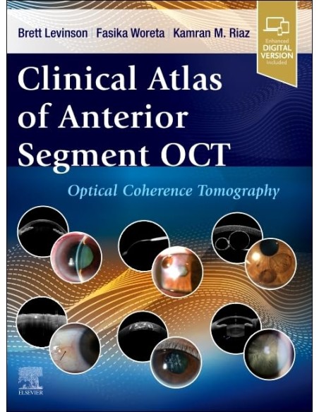 Clinical atlas of anterior segment oct optical coherence