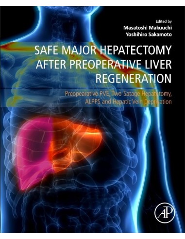 Safe major hepatectomy after preoperative liver regeneratio