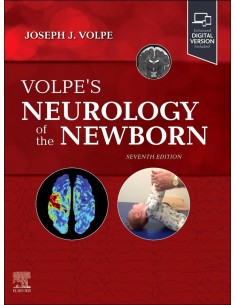 Volpes neurology of the newborn