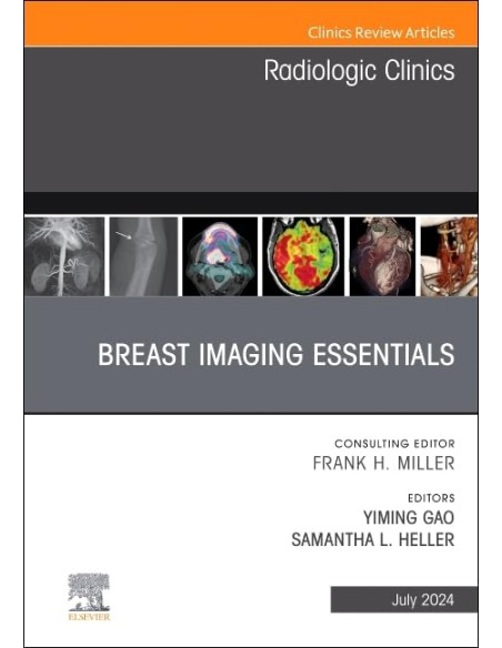 Breast imaging essentials an issue radiologic clinics