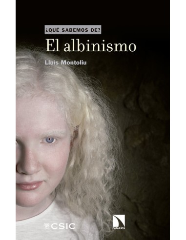 EL ALBINISMO
